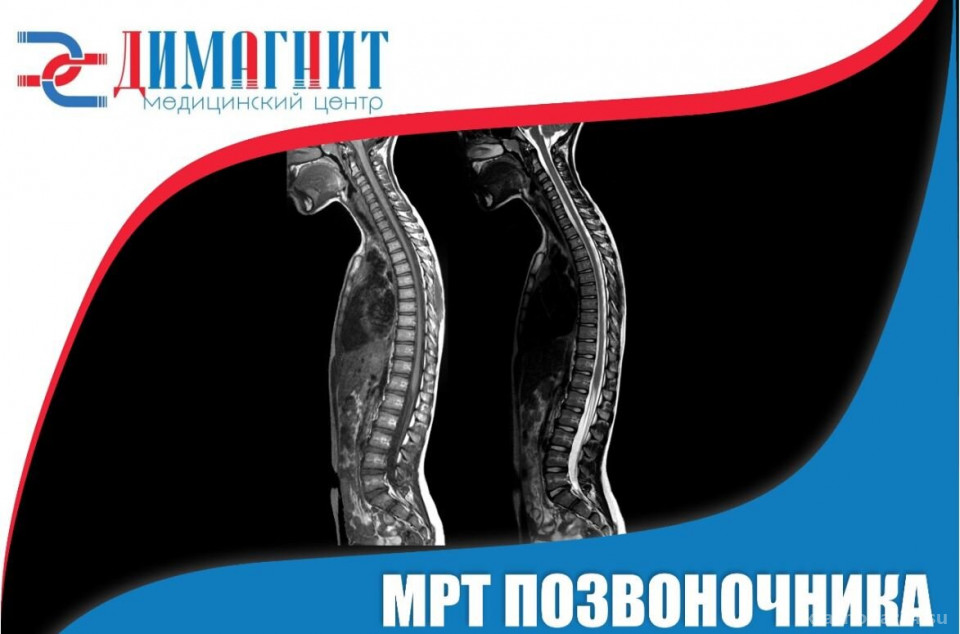 Позвоночник воронеж. Мрт позвоночника по акции. Мрт позвоночника в Иркутске. Мрт шейного отдела позвоночника Иркутск. Мрт позвоночника в Воронеже.