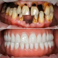 Авторская стоматологическая клиника М-Дента фотография 2